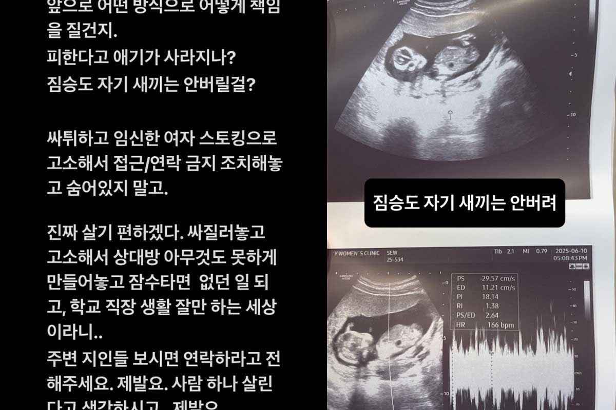 출처 : 서민재 SNS